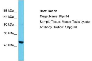 Western Blotting (WB) image for anti-Protein tyrosine Phosphatase, Non-Receptor Type 14 (PTPN14) (N-Term) antibody (ABIN2786811)