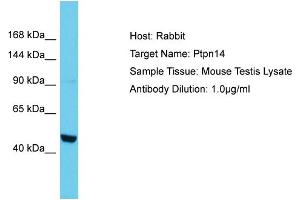 Host: Rabbit Target Name: PTPN14 Sample Tissue: Mouse Testis Antibody Dilution: 1ug/ml (PTPN14 抗体  (N-Term))