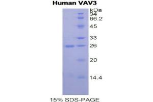 SDS-PAGE analysis of Human Vav 3 Oncogene Protein. (VAV3 蛋白)