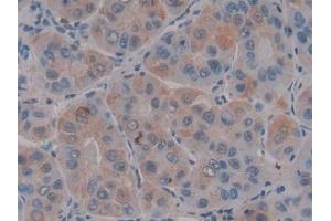Immunohistochemistry (IHC) image for anti-Chemokine (C-X-C Motif) Ligand 12 (CXCL12) (AA 23-89) antibody (ABIN7431116)