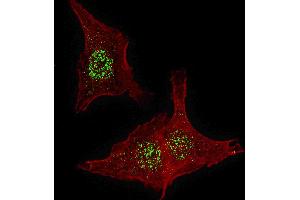 Fluorescent confocal image of HeLa cells stained with FGFR4 antibody. (FGFR4 抗体  (N-Term))