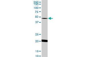 NADK monoclonal antibody (M01), clone 5F4 Western Blot analysis of NADK expression in HeLa . (NADK 抗体  (AA 1-446))