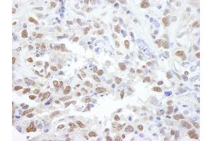 Immunohistochemistry (IHC) image for anti-Protein Phosphatase 4, Catalytic Subunit (PPP4C) (AA 1-50) antibody (ABIN7448739) (PPP4C 抗体  (AA 1-50))