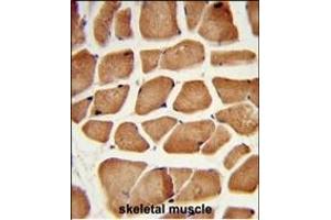 Immunohistochemistry (Paraffin-embedded Sections) (IHC (p)) image for anti-Enoyl-CoA Delta Isomerase 2 (PECI) (AA 331-358), (C-Term) antibody (ABIN652636)