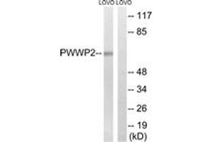 Western blot analysis of extracts from LOVO cells, using PWWP2B Antibody. (PWWP2B 抗体  (AA 268-317))