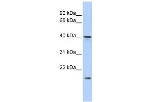 SLAIN1 antibody used at 1 ug/ml to detect target protein. (SLAIN1 抗体  (Middle Region))