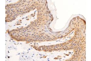 ABIN6267308 at 1/100 staining human skin tissue sections by IHC-P. (C-JUN 抗体  (pTyr170))
