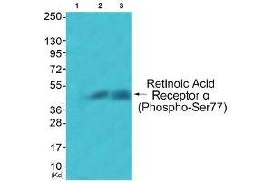 Western blot analysis of extracts from JK cells (Lane 2) and COS7 cells (Lane 3), using Retinoic Acid Receptor α (Phospho-Ser77) Antibody. (Retinoic Acid Receptor alpha 抗体  (pSer77))