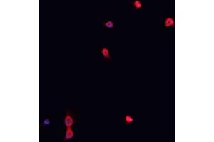 ABIN6267023 staining K-562 cells by IF/ICC. (Nibrin 抗体  (pSer278))