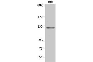 Western Blotting (WB) image for anti-PTK2 Protein tyrosine Kinase 2 (PTK2) (Thr435) antibody (ABIN3180042) (FAK 抗体  (Thr435))
