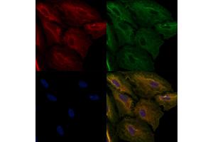 ABIN6257890 and ABIN6274946 staining  cells by IF/ICC. (CAGE1 抗体  (C-Term))