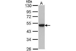 WB Image Sample (30 ug of whole cell lysate) A: Hela 10% SDS PAGE antibody diluted at 1:1000 (Keratin 31 抗体)