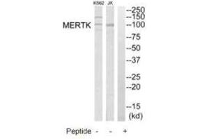 Western blot analysis of extracts from K562 cells and Jurkat cells, using MERTK antibody. (MERTK 抗体  (N-Term))