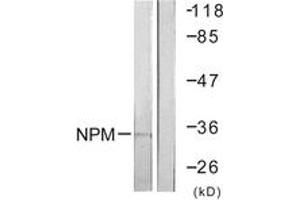 Western blot analysis of extracts from Jurkat cells, using NPM (Ab-199) Antibody. (NPM1 抗体  (AA 171-220))