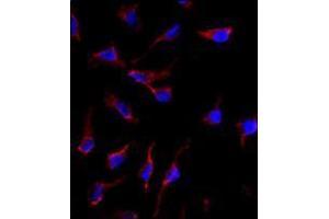 Image no. 3 for anti-KIT Ligand (KITLG) (C-Term) antibody (ABIN357009) (KIT Ligand 抗体  (C-Term))