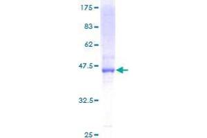 DHRS11 Protein (AA 1-181) (GST tag)