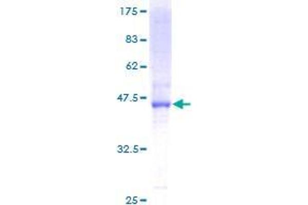 DHRS11 Protein (AA 1-181) (GST tag)