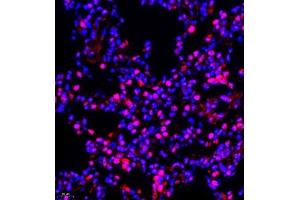 Immunofluorescence (Paraffin-embedded Sections) (IF (p)) image for anti-NSFL1 (p97) Cofactor (p47) (NSFL1C) antibody (ABIN7074865)