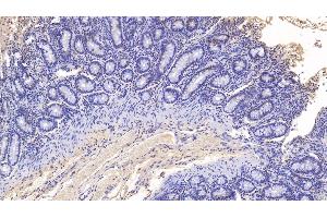 Detection of MPO in Bovine Colon Tissue using Monoclonal Antibody to Myeloperoxidase (MPO) (Myeloperoxidase 抗体)