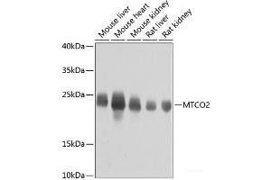 Western blot analysis of extracts of various cell lines using MTCO2 Polyclonal Antibody at dilution of 1:800. (COX2 抗体)