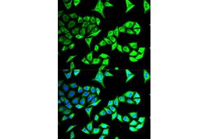 Immunofluorescence analysis of MCF-7 cells using GABARAP antibody (ABIN6129966, ABIN6140874, ABIN6140877 and ABIN6221250).
