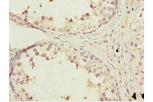 Immunohistochemistry of paraffin-embedded human testis tissue using ABIN7157257 at dilution of 1:100 (KBTBD7 抗体  (AA 475-684))