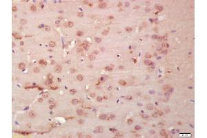Immunohistochemistry (IHC) image for anti-Tubulin, beta (TUBB) (AA 61-160) antibody (ABIN706721)