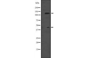 Western blot analysis of MCM9 expression in Rat brain tissue lysate ,The lane on the left is treated with the antigen-specific peptide. (MCM9 抗体  (C-Term))