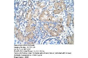 Rabbit Anti-UROD Antibody  Paraffin Embedded Tissue: Human Kidney Cellular Data: Epithelial cells of renal tubule Antibody Concentration: 4. (UROD 抗体  (N-Term))