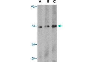 Western blot analysis of PLXDC1 in human liver tissue lysate with PLXDC1 polyclonal antibody  at (A) 0. (PLXDC1 抗体  (C-Term))