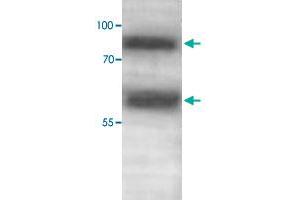 Western blot analysis of human fetal skeletal muscle lysate with ADAMTS1 polyclonal antibody  at 1 : 500 dilution. (ADAMTS1 抗体  (C-Term))