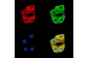 ABIN7096380 and ABIN7100444 staining Hela cells by IF/ICC. (PMPCA 抗体)