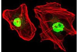 Image no. 3 for anti-Replication Protein A1, 70kDa (RPA1) antibody (ABIN1500741) (RPA1 抗体)