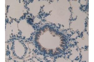 Immunohistochemistry (IHC) image for anti-Matrix Metallopeptidase 9 (Gelatinase B, 92kDa Gelatinase, 92kDa Type IV Collagenase) (MMP9) (AA 226-391) antibody (ABIN7432019)