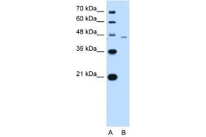 WB Suggested Anti-SMAD7 Antibody Titration:  1. (SMAD7 抗体  (N-Term))