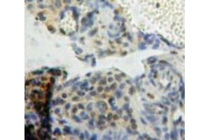 IHC-P analysis of Ovary tissue, with DAB staining. (BCL9 抗体  (AA 1119-1328))