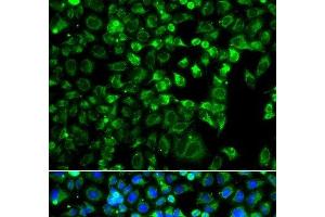 Immunofluorescence analysis of A549 cells using ZAK Polyclonal Antibody (ZAK 抗体)