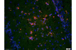 Immunohistochemistry (Paraffin-embedded Sections) (IHC (p)) image for anti-Neurotrophic Tyrosine Kinase, Receptor, Type 1 (NTRK1) (AA 725-821) antibody (ABIN726110)