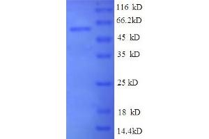 SDS-PAGE (SDS) image for Ribonuclease, RNase A Family, 4 (RNASE4) (AA 2-247), (partial) protein (GST tag) (ABIN5712221) (RNASE4 Protein (AA 2-247, partial) (GST tag))