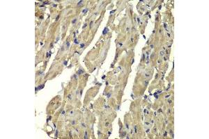 Immunohistochemistry of paraffin-embedded mouse heart using FXN antibody. (Frataxin 抗体  (AA 42-210))