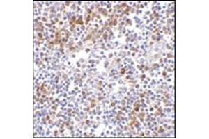 Immunohistochemistry of MDA5 in human lymph node tissue with this product at 5 μg/ml. (IFIH1 抗体  (C-Term))