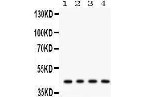 Anti- ADIPOR1 Picoband antibody, Western blotting All lanes: Anti ADIPOR1  at 0. (Adiponectin Receptor 1 抗体  (N-Term))