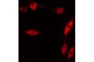 ABIN6276522 staining  COLO205 cells by IF/ICC. (APEX1 抗体  (N-Term))