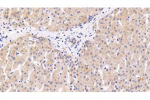 Immunohistochemistry (IHC) image for anti-Lysosomal-Associated Membrane Protein 2 (LAMP2) (AA 193-375) antibody (ABIN7438691)