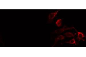 ABIN6274373 staining HT29 cells by IF/ICC. (RHOH 抗体  (Internal Region))