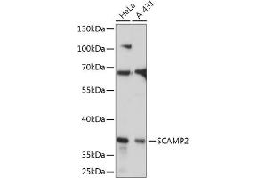Western blot analysis of extracts of various cell lines, using SC antibody (ABIN7270188) at 1:1000 dilution. (SCAMP2 抗体  (AA 1-152))