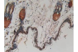IHC-P analysis of Mouse Skin Tissue, with DAB staining. (CASP14 抗体  (AA 1-257))