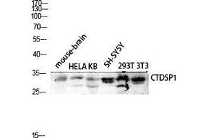 Western Blot (WB) analysis of Mouse Brain HeLa KB SH-SY5Y 293T 3T3 lysis using CTDSP1 antibody. (CTDSP1 抗体  (N-Term))