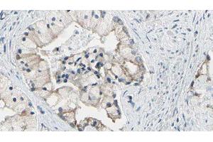ABIN6278120 at 1/100 staining Human prostate tissue by IHC-P. (TRIM29 抗体  (Internal Region))