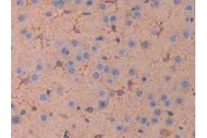 IHC-P analysis of Mouse Cerebrum Tissue, with DAB staining. (IL11RA 抗体  (AA 59-217))